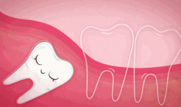 拔智齿视频,视频带你直观体验